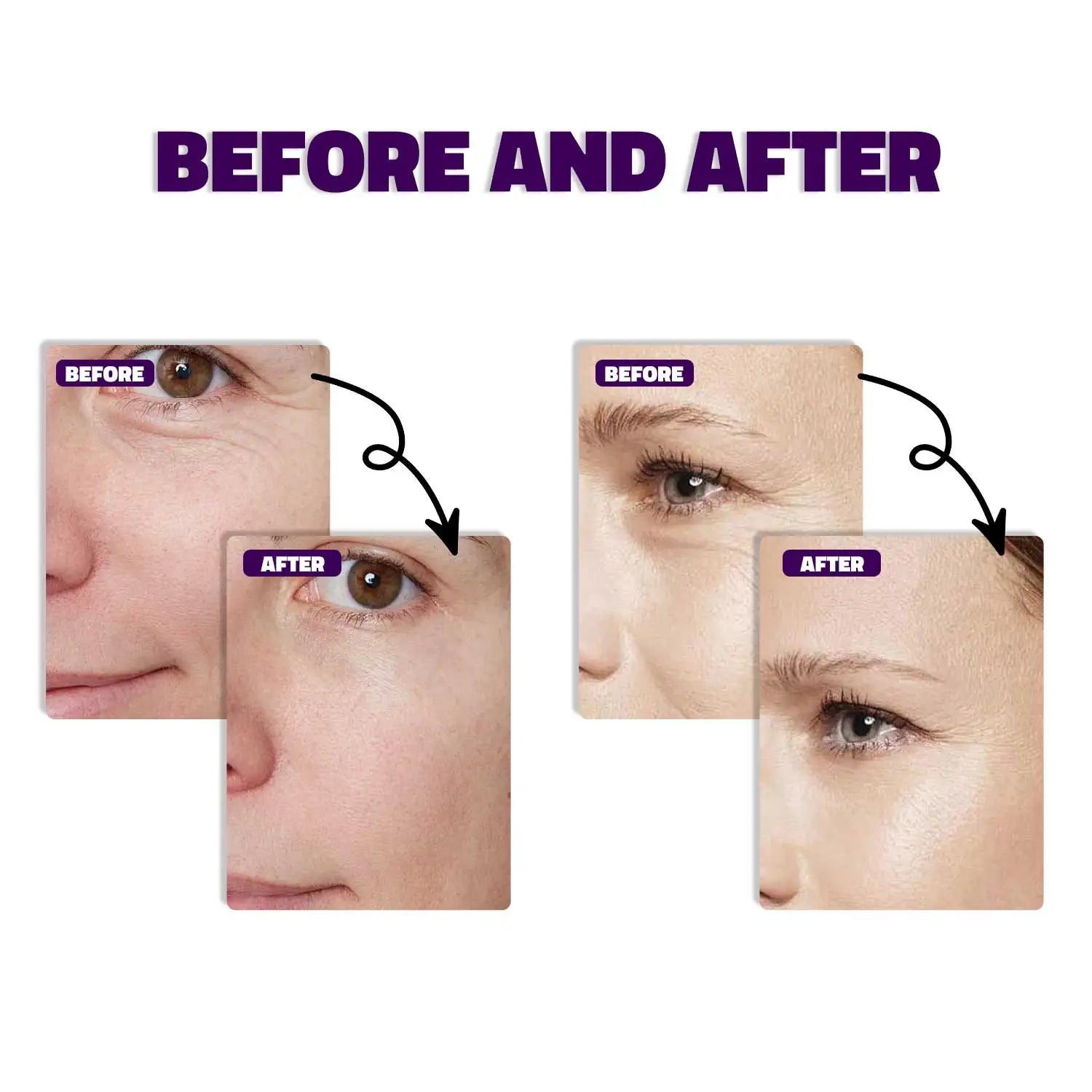 30ml Bakuchiol & Retinol Serum – Moisturizing, Firming, Anti-Aging for Women